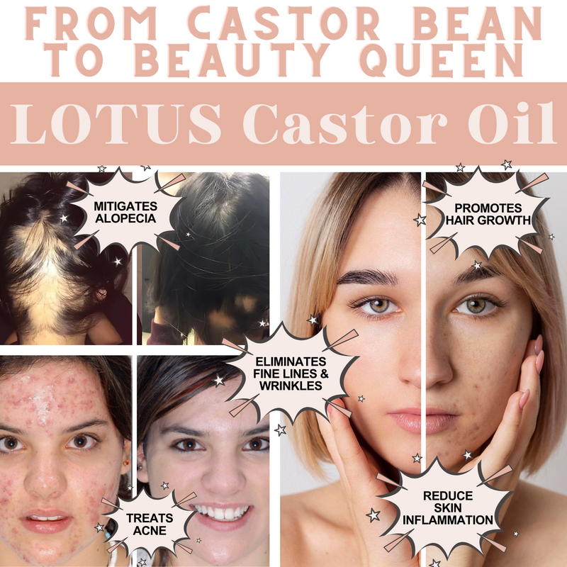 LOTUS Castor Oil