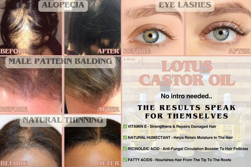 LOTUS Castor Oil